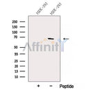 Western blot analysis of extracts from HEK-293 cells, using Arp5/ACTR5 Antibody. The lane on the left was treated with blocking peptide.