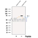 Western blot analysis of extracts from Mouse brain tissue, using ASIC2 Antibody. The lane on the left was treated with blocking peptide.