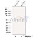 Western blot analysis of extracts from HEK-293 cells, using ATL3 Antibody. The lane on the left was treated with blocking peptide.