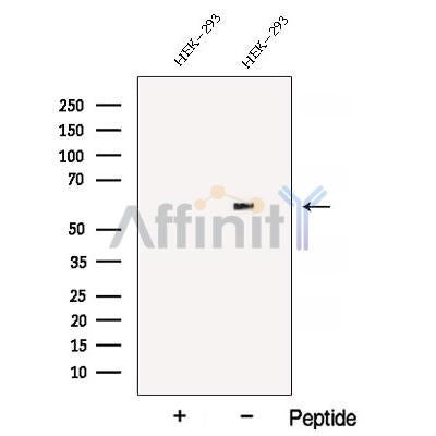 Western blot analysis of extracts from HEK-293 cells, using ATL3 Antibody. The lane on the left was treated with blocking peptide.