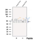 Western blot analysis of extracts from Myeloma cells, using ATP1B2 Antibody. The lane on the left was treated with blocking peptide.