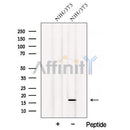 Western blot analysis of extracts from NIH/3T3 cells, using ATP5D Antibody. The lane on the left was treated with blocking peptide.