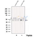 Western blot analysis of extracts from Mouse lung tissue, using B3GNT3 Antibody. The lane on the left was treated with blocking peptide.