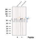 Western blot analysis of extracts from B16F10, using BANP Antibody. The lane on the left was treated with blocking peptide.
