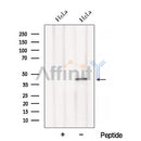Western blot analysis of extracts from HeLa cells, using BCAT1/ECA39 Antibody. The lane on the left was treated with blocking peptide.