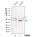 Western blot analysis of extracts from HepG2 cells, using BCAT2 Antibody. The lane on the left was treated with blocking peptide.