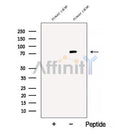 Western blot analysis of extracts from RAW264.7, using Bestrophin-3 Antibody. The lane on the left was treated with blocking peptide.