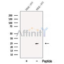 Western blot analysis of extracts from HEK-293 cells, using BMF Antibody. The lane on the left was treated with blocking peptide.