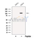 Western blot analysis of extracts from HeLa cells, using BRD2 Antibody. The lane on the left was treated with blocking peptide.