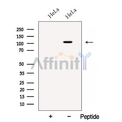 Western blot analysis of extracts from HeLa cells, using BRD2 Antibody. The lane on the left was treated with blocking peptide.