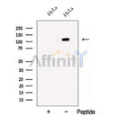 Western blot analysis of extracts from HeLa cells, using BRD8 Antibody. The lane on the left was treated with blocking peptide.