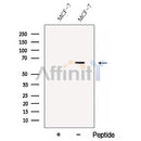 Western blot analysis of extracts from MCF-7 cells, using C13orf18 Antibody. The lane on the left was treated with blocking peptide.