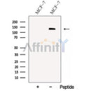 Western blot analysis of extracts from various samples, using C14orf102 Antibody.
 Lane 1: HepG2 treated with blocking peptide;
 Lane 2: HepG2;
 Lane 3: B16F10.