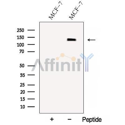 Western blot analysis of extracts from various samples, using C14orf102 Antibody.
 Lane 1: HepG2 treated with blocking peptide;
 Lane 2: HepG2;
 Lane 3: B16F10.