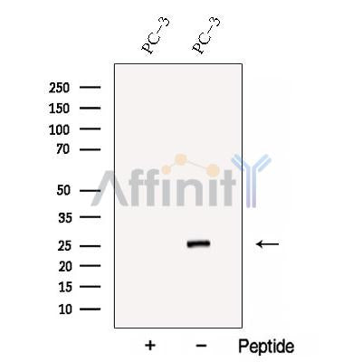 Western blot analysis of extracts from Mouse  lung, using C1orf163 Antibody. The lane on the left was treated with blocking peptide.