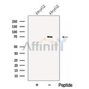 Western blot analysis of extracts from HepG2 cells, using C4BPA Antibody. The lane on the left was treated with blocking peptide.
