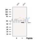 Western blot analysis of extracts from ?A549 cells, using C5orf4 Antibody. The lane on the left was treated with blocking peptide.