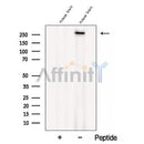 Western blot analysis of extracts from Mouse brain tissue, using CACNA1B Antibody. The lane on the left was treated with blocking peptide.