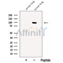 Western blot analysis of extracts from various samples, using Calmegin Antibody.
 Lane 1: Rat  brain, treated with blocking peptide;
 Lane 2: Rat  brain;
 Lane 3: Mouse  lung.