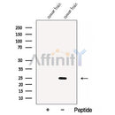 Western blot analysis of extracts from Mouse brain tissue, using CALN1 Antibody. The lane on the left was treated with blocking peptide.