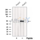 Western blot analysis of extracts from B16F10, using Calumenin Antibody. The lane on the left was treated with blocking peptide.