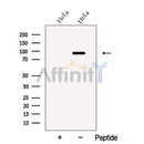 Western blot analysis of extracts from HeLa cells, using CARNS1 Antibody. The lane on the left was treated with blocking peptide.