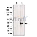 Western blot analysis of extracts from A549 cells, using Cathepsin L Antibody. The lane on the left was treated with blocking peptide.