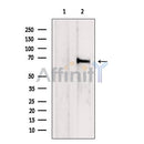 Western blot analysis of extracts from HeLa cells, using CBFA2T2 Antibody. The lane on the left was treated with blocking peptide.
