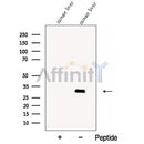 Western blot analysis of extracts from Mouse liver tissue?, using CBY1 Antibody. The lane on the left was treated with blocking peptide.