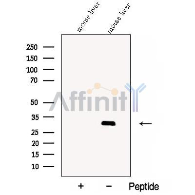 Western blot analysis of extracts from Mouse liver tissue?, using CBY1 Antibody. The lane on the left was treated with blocking peptide.