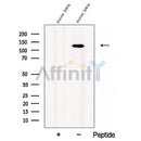 Western blot analysis of extracts from Mouse brain tissue, using CC2D1B Antibody. The lane on the left was treated with blocking peptide.