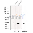 Western blot analysis of extracts from Human liver tissue, using CCDC53 Antibody. The lane on the left was treated with blocking peptide.