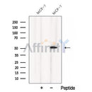 Western blot analysis of extracts from MCF-7 cells, using CCM2 Antibody. The lane on the left was treated with blocking peptide.
