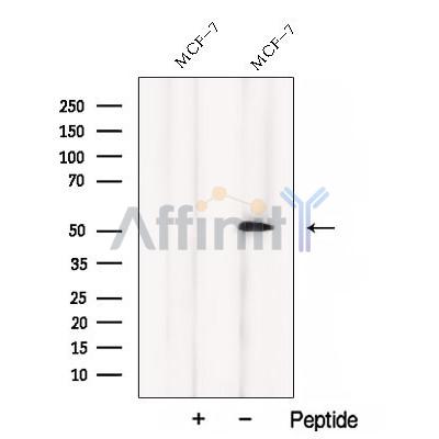 Western blot analysis of extracts from MCF-7 cells, using CCM2 Antibody. The lane on the left was treated with blocking peptide.