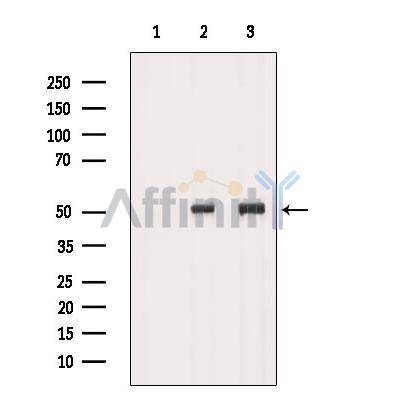 Western blot analysis of extracts from HeLa cells, using CCT4 Antibody. The lane on the left was treated with blocking peptide.