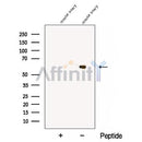 Western blot analysis of extracts from Mouse ovary  tissue, using CCT6B Antibody. The lane on the left was treated with blocking peptide.