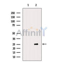 Western blot analysis of extracts from HeLa cells, using CDC26 Antibody. The lane on the left was treated with blocking peptide.