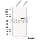 Western blot analysis of extracts from Human brain tissue, using CDR2 Antibody. The lane on the left was treated with blocking peptide.