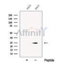 Western blot analysis of extracts from A431 cells, using CHMP1A Antibody. The lane on the left was treated with blocking peptide.
