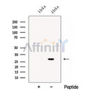 Western blot analysis of extracts from HeLa cells, using CHMP1B Antibody. The lane on the left was treated with blocking peptide.