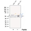 Western blot analysis of extracts from HEK-293 cells, using CHMP7 Antibody. The lane on the left was treated with blocking peptide.