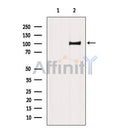 Western blot analysis of extracts from Mouse brain tissue, using Chromogranin B Antibody. The lane on the left was treated with blocking peptide.