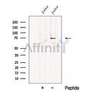 Western blot analysis of extracts from ?Jurkat cells, using CHST15 Antibody. The lane on the left was treated with blocking peptide.