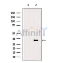 Western blot analysis of extracts from MCF-7 cells, using SARNP Antibody. The lane on the left was treated with blocking peptide.