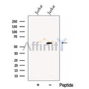 Western blot analysis of extracts from Jurkat cells, using CNOT6 Antibody. The lane on the left was treated with blocking peptide.