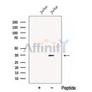 Western blot analysis of extracts from Jurkat cells, using CNOT8 Antibody. The lane on the left was treated with blocking peptide.