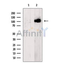 Western blot analysis of extracts from HeLa cells, using COG3 Antibody. The lane on the left was treated with blocking peptide.