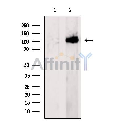 Western blot analysis of extracts from HeLa cells, using COG3 Antibody. The lane on the left was treated with blocking peptide.