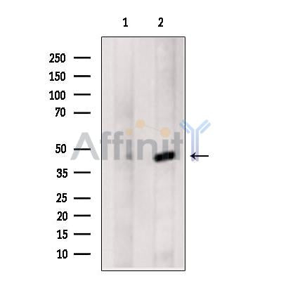 Western blot analysis of extracts from A431 cells, using Connexin-46 Antibody. The lane on the left was treated with blocking peptide.