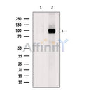 Western blot analysis of extracts from Mouse brain tissue?, using COPG2 Antibody. The lane on the left was treated with blocking peptide.
